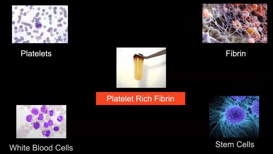 prf components